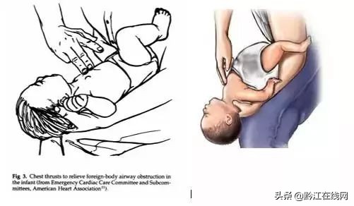 儿童被食物噎救助法,小孩吃东西噎住求助警察