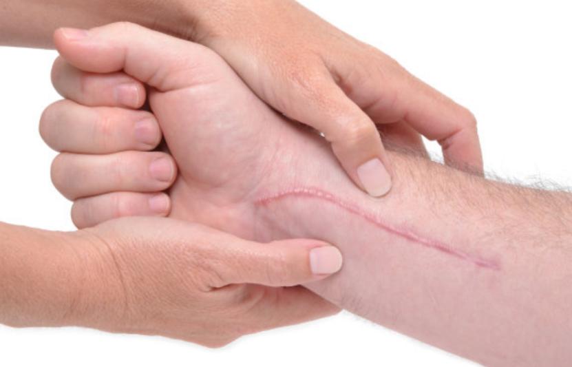 受伤的伤疤愈合后为什么还痛,好了伤疤忘了疼为什么