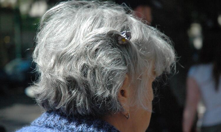 告别染发剂有了白发不用愁,告别染发剂改善头皮所有问题