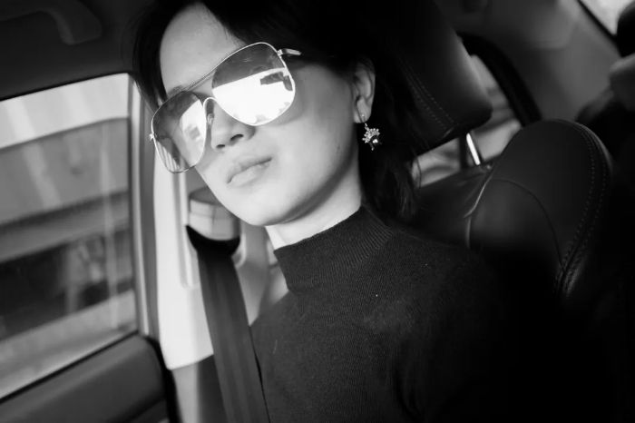 激光近视手术后的恢复过程,激光近视手术超越常识的后遗症