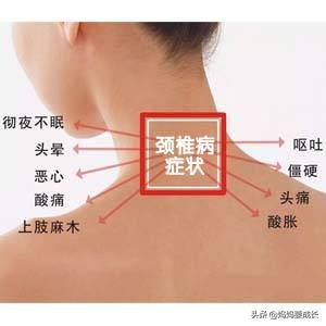 颈椎病为什么越锻炼越重,颈椎病手麻会不会越来越厉害