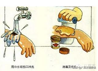 孩子被开水烫伤了该如何紧急处理,烫伤紧急处理的五字口诀