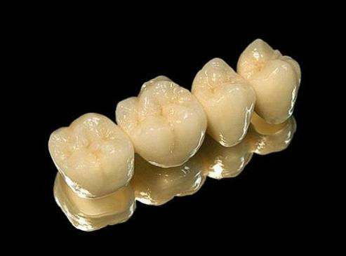 假牙价格一览表图片,假牙种类及价格表图片