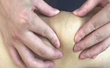 髌骨骨折康复后会留哪些后遗症,髌骨骨折手术康复训练视频动作