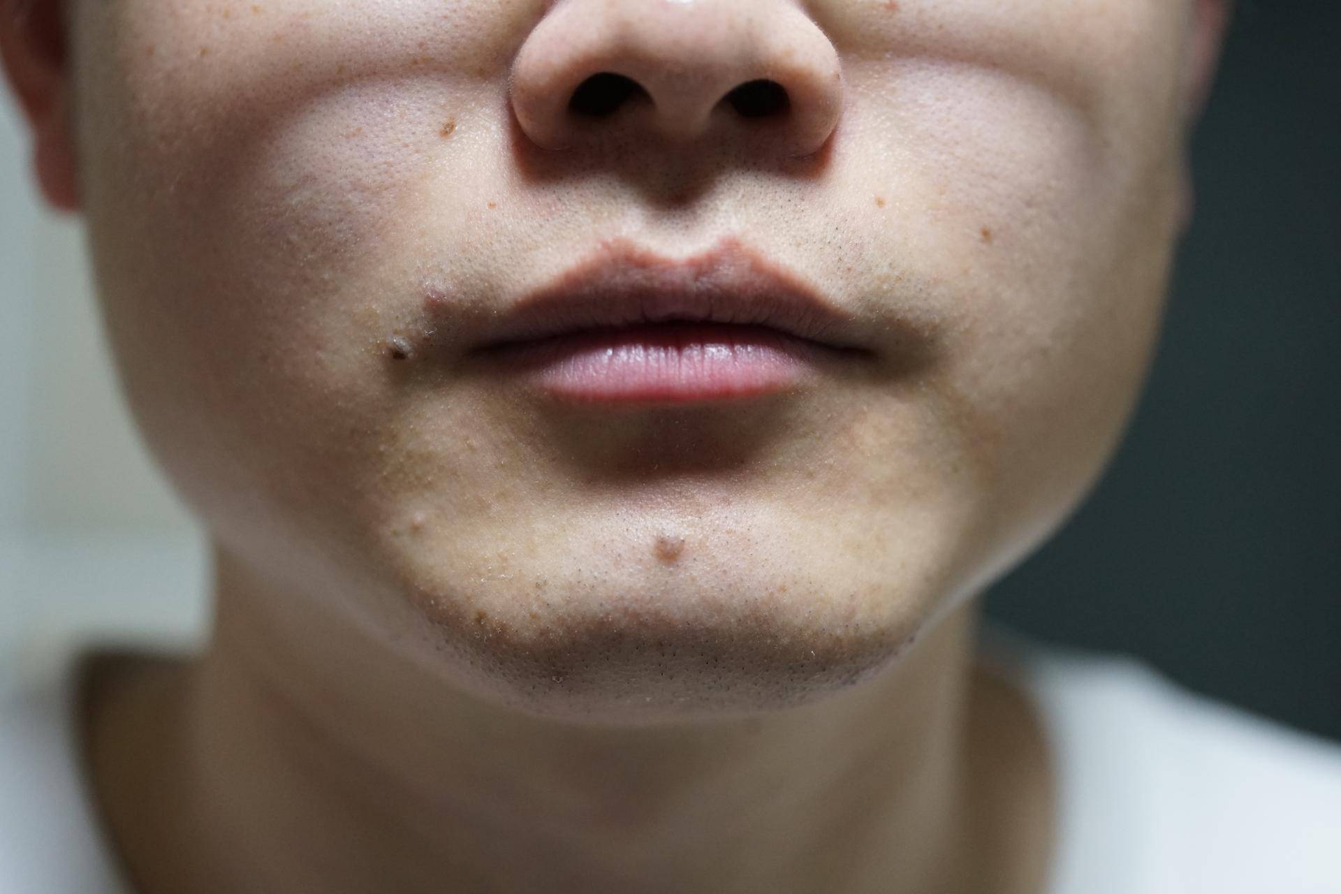 飞利浦series2000系,飞利浦series2000功能介绍