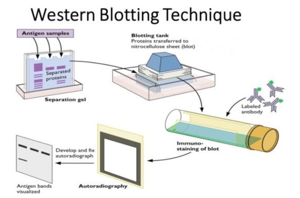 解密论文造假重灾区，ElisabethBik博士亲授WB实验技巧