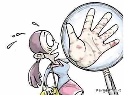 皮肤科那些事,皮肤科什么病最严重