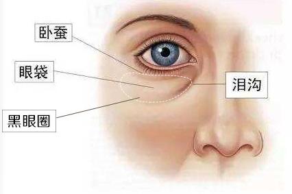 眼睛有眼袋是脾虚还是肾虚,眼睛充血要警惕四种疾病