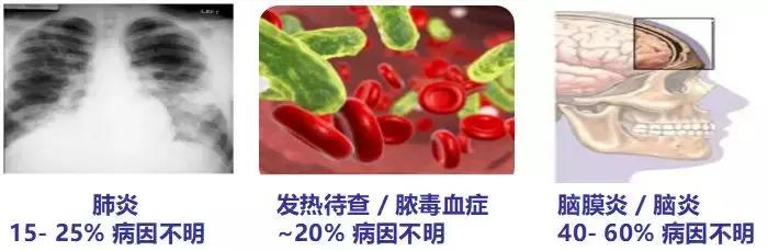 mngs病原检测的优势,mngs真的可靠吗