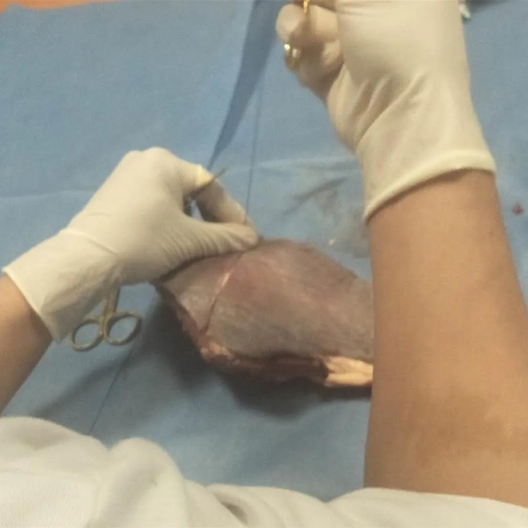 组织缝合技术教学,间断缝合完整流程教学