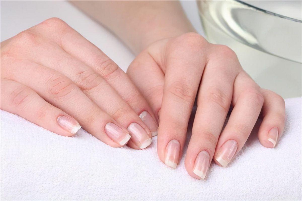 指甲上出现竖纹是身体出现了状况,如果指甲上有竖纹要注意了