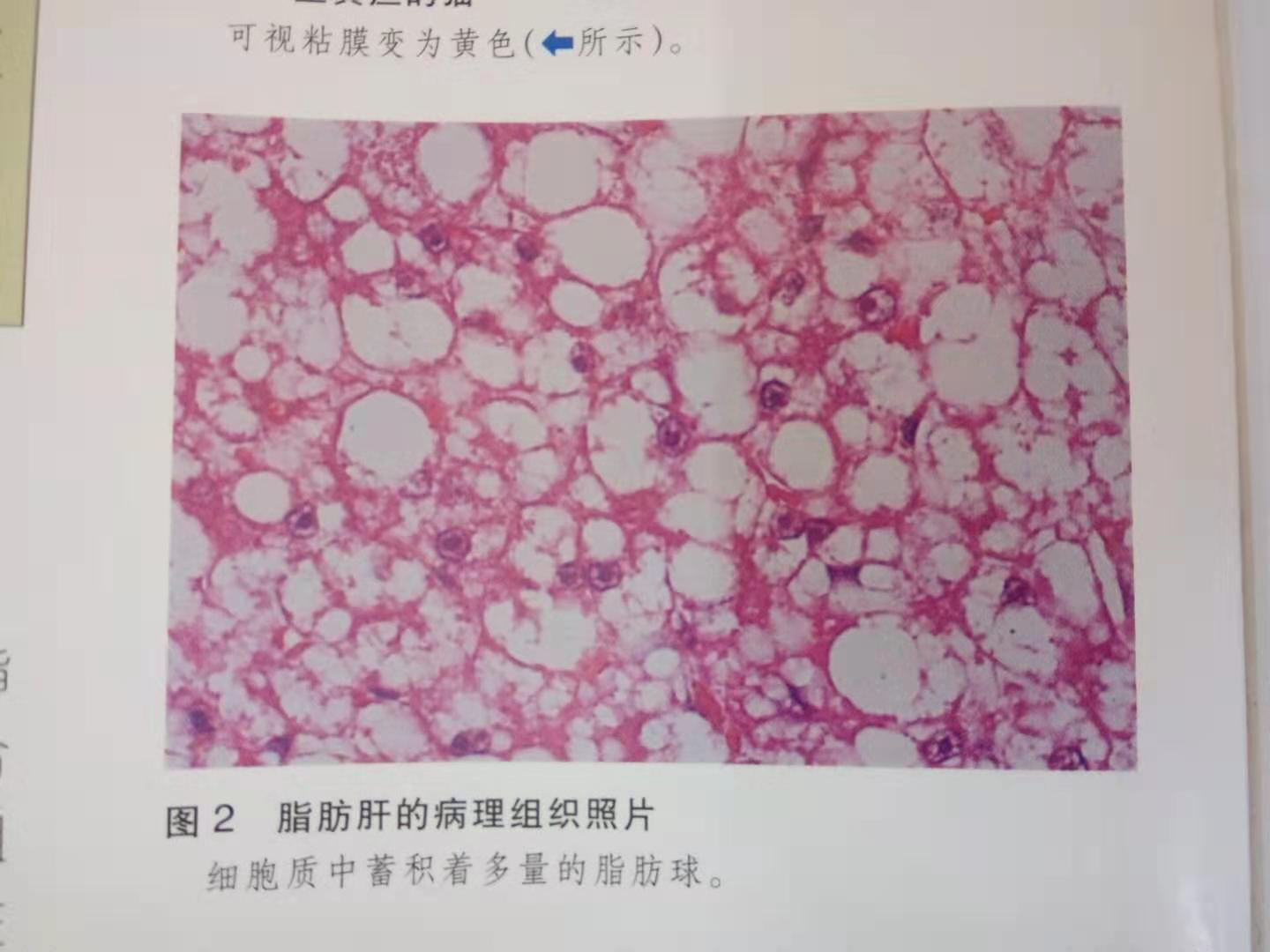 猫脂肪肝消除最快方法,猫脂肪肝治疗需要花多少钱