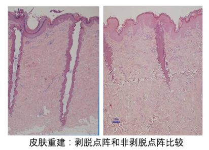 39岁高圆圆产后首次晒照,40岁高圆圆产后首次亮相