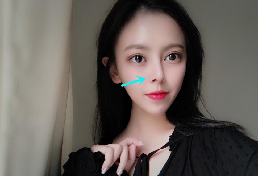 00后整容真的那么重要吗,00后现在整容普遍