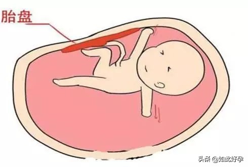 孕妇中期突然腹痛一下,孕妇强忍阵痛走路