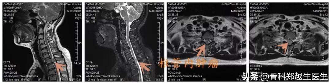 腰椎、颈椎疼痛，能不能推拿按摩治疗？骨科医生提出了这样的意见