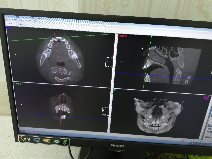 在口腔上班经历,口腔医院打工需要干什么