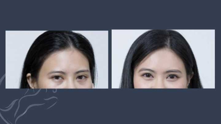 眼睛无神呆滞怎么训练,如何训练眼睛更有神仿佛眼里有光