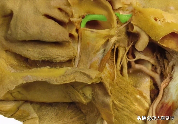 偏头痛怎么用手法缓解,偏头痛的手法治疗