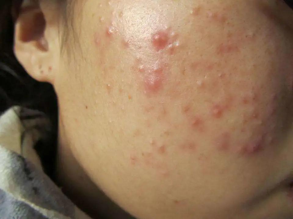 「韩源昌」孕期到底能不能用护肤品？