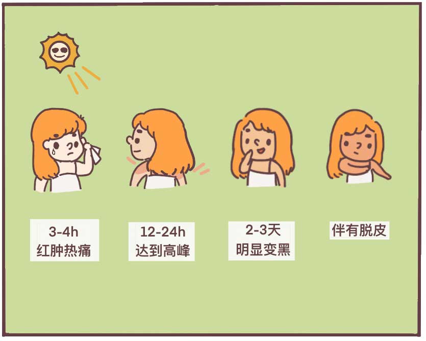 晒伤皮肤发红怎么快速消除,皮肤晒伤后怎么处理呢