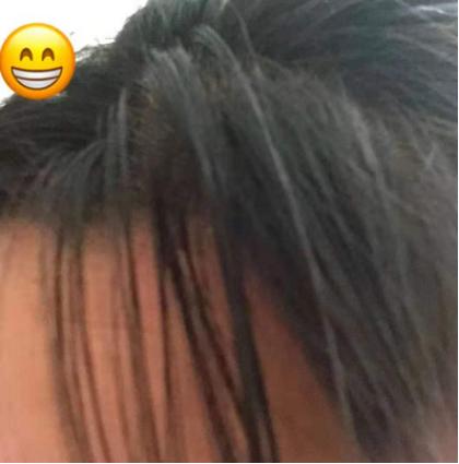 男士有头皮屑油腻用什么洗发水,头发油头皮屑多有什么洗发水推荐