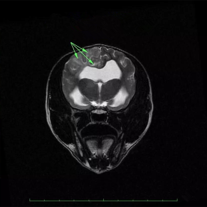 狗狗蛀牙看似轻微却暗藏隐患！鼻窦炎、脑膜炎等问题不容小视