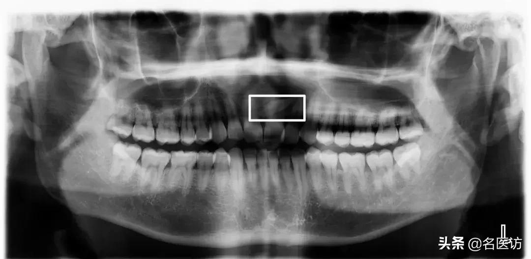 矫正牙科普馆,矫正牙齿科普知识