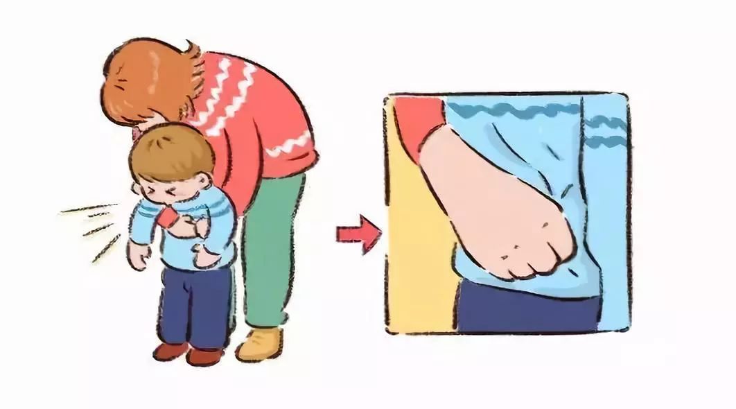 宝宝被噎住海姆立克,宝宝被食物噎到怎么办