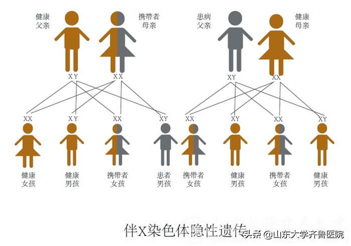齐鲁医院有遗传咨询科吗,济南齐鲁医院遗传病科