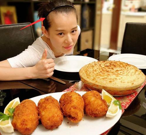 女生为啥发际线秃了,30岁发际线变秃