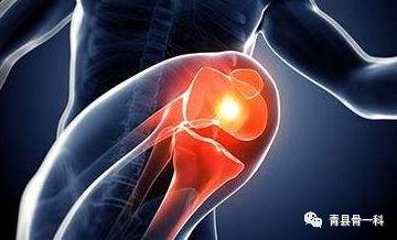 腿疼膝盖积液是什么原因,腿疼膝盖响是什么原因呢