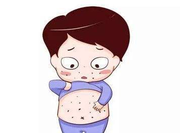 宝宝麻疹来袭，妈妈们别着急，几个护理的小方法让孩子远离侵袭！