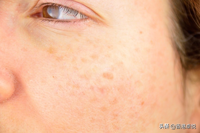 口罩神器医护专用口罩,口罩救星