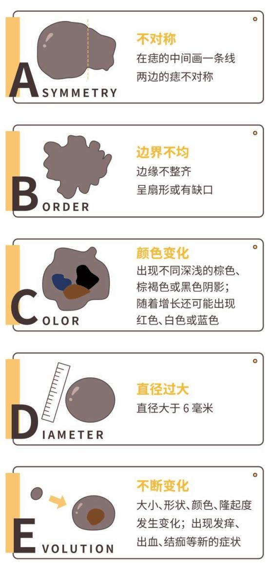 一般凸起的黑痣会癌变吗,长了20多年的黑痣有可能会癌变吗