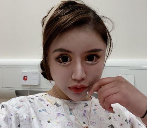19岁少女因自己长得丑要去整容,13岁女孩变丑