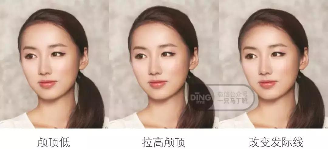 颅顶太低如何自救,颅顶低怎么自救