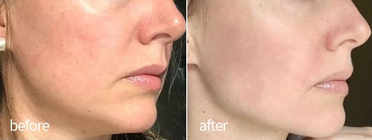 琚佸濮楄憽钀勭苯绮惧崕,琚佸濮楁帹鑽愯憽钀勭苯鎶よ偆