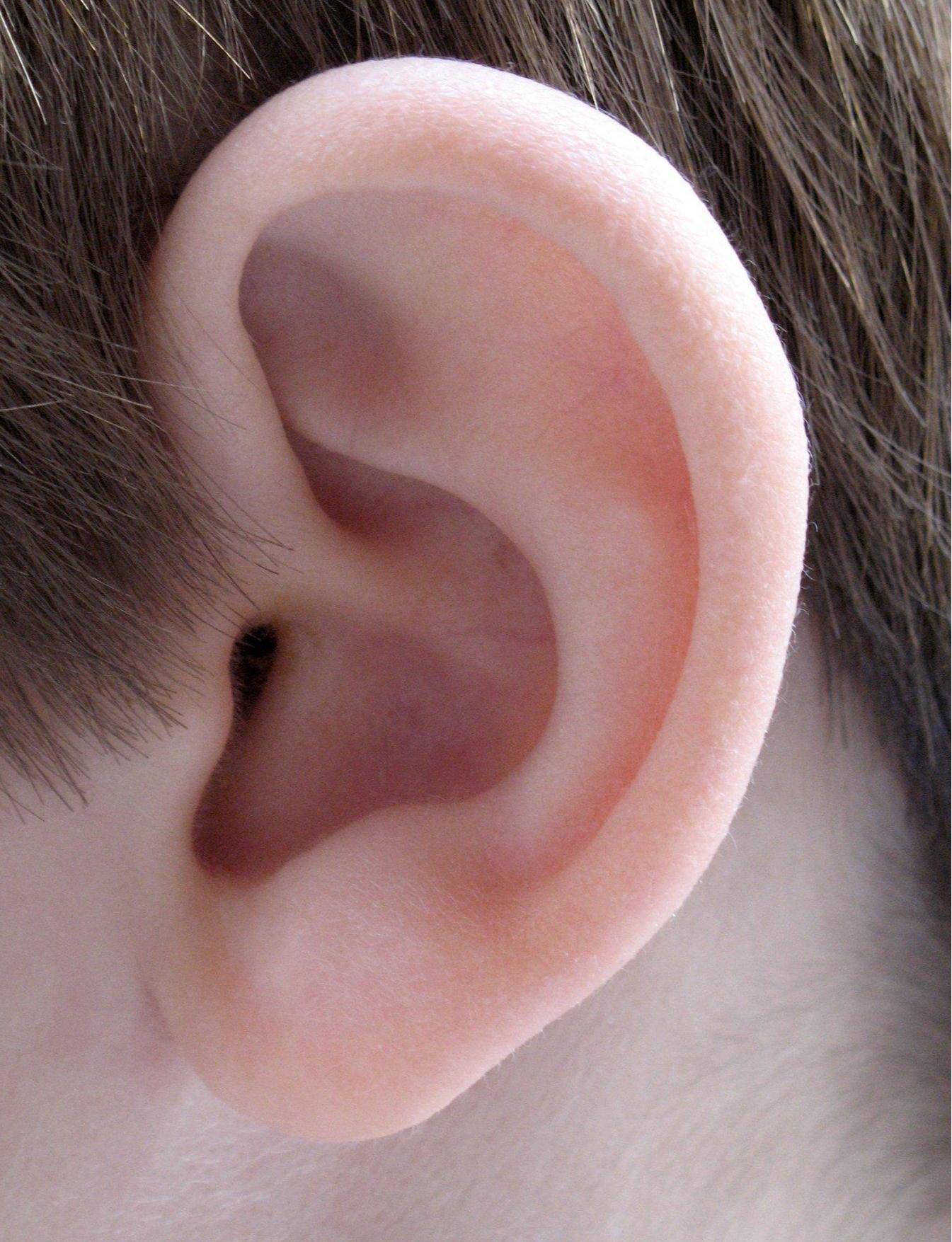 非器质性耳聋,器质性耳聋的分型