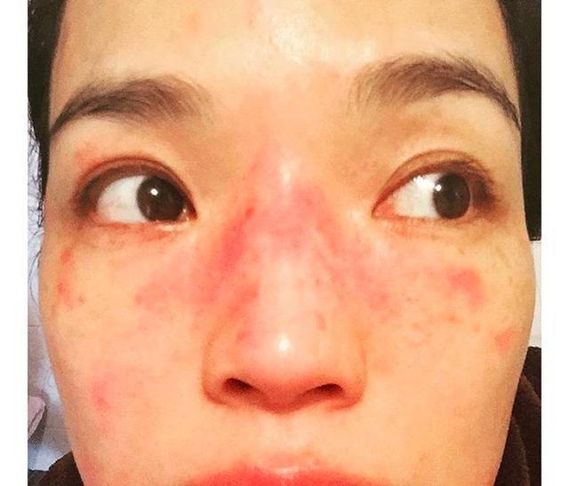 最新美妆护肤产品推荐敏感肌,敏感肌专用护肤推荐