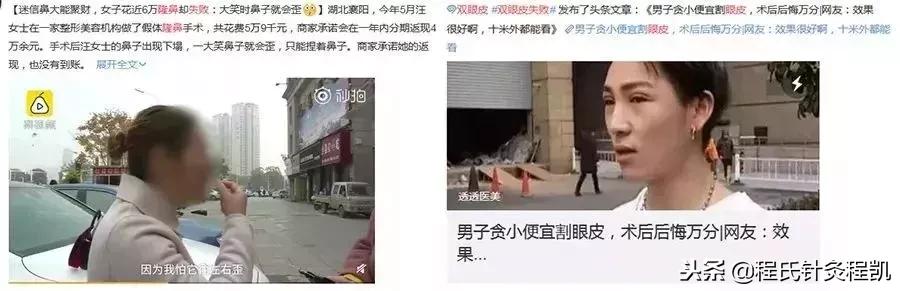 不要在脸上动任何刀,不要轻易在脸上动刀