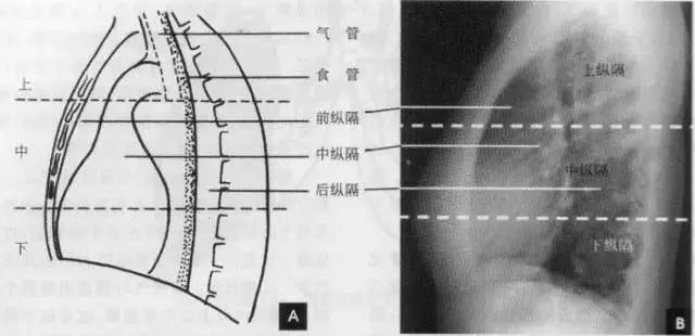 拿到胸部ct我们该怎么看,怎样看懂胸片报告单