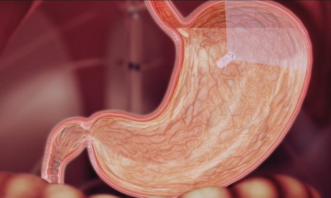 澶у湥纾佹帶鑳跺泭鑳冮暅鎿嶄綔瑙嗛,澶у湥纾佹帶鑳跺泭鑳冮暅