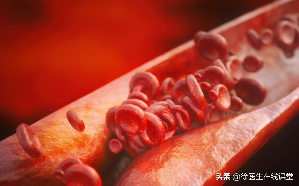 心脏三根血管都堵80%需要下支架吗,下了心脏支架血压低是什么问题