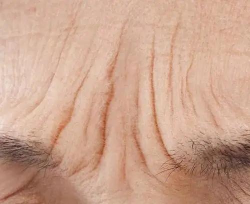 科普眉间纹,说说心里的那些事