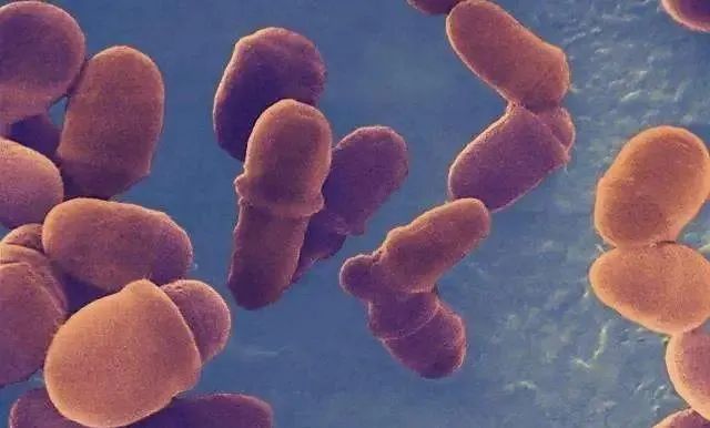 为什么用去屑洗发水头屑越多,为什么头屑洗不掉反而越洗越多