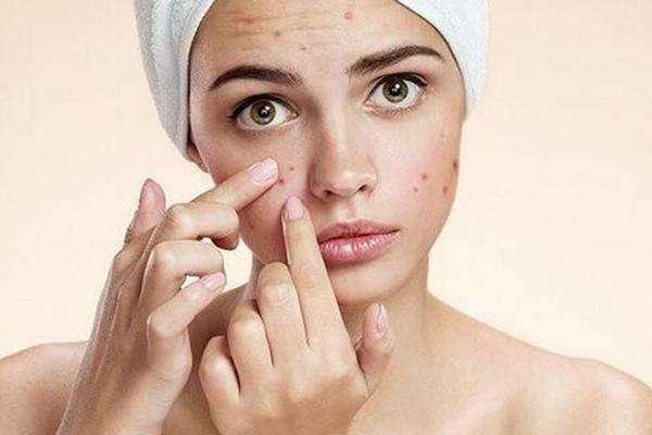 100人里就有20人中招，清洁不到位导致脸上冒虫，毛孔需要早清洁