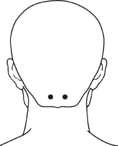 眼底黄斑病变针灸治疗,黄斑性眼病针灸治疗