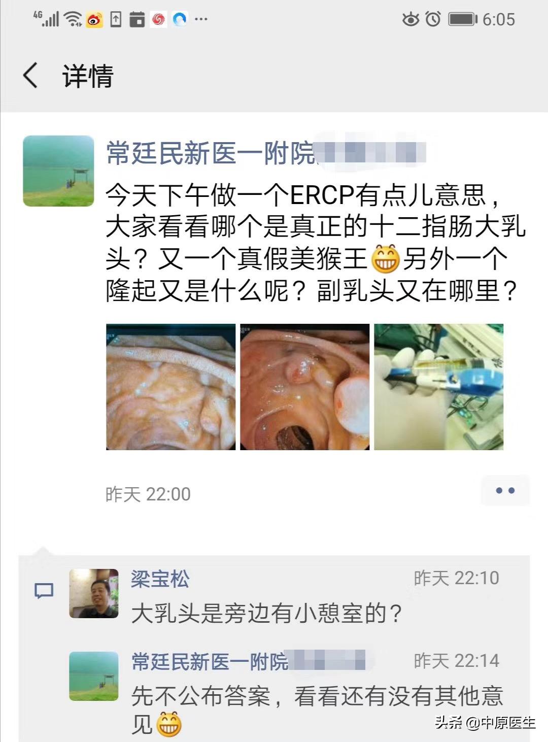 十二指肠与哪个器官对应,与十二指肠相邻的有哪些器官