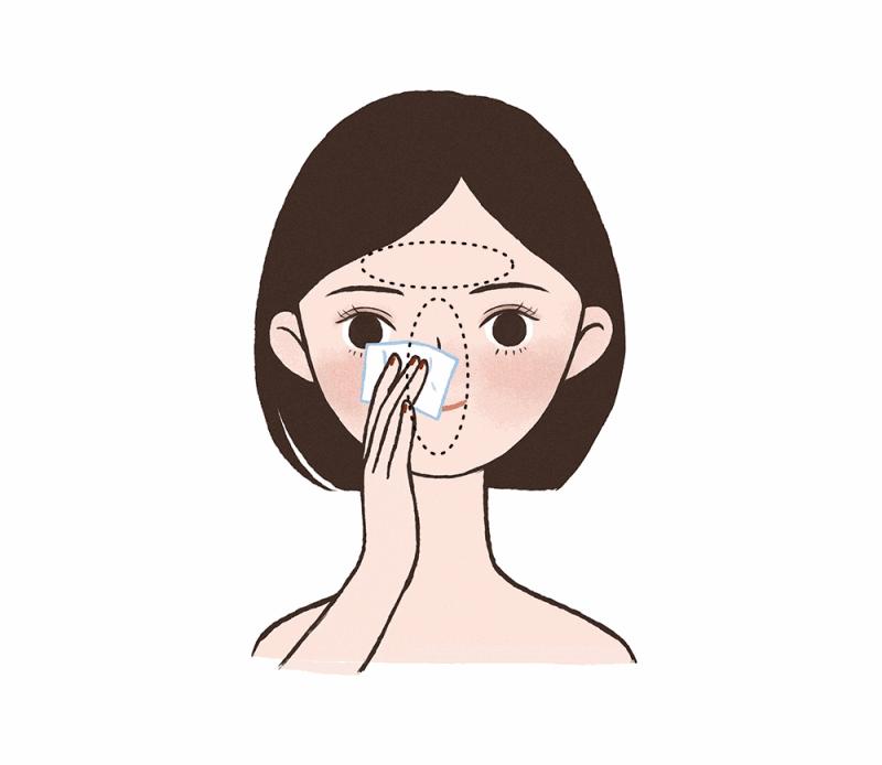 脸颊两侧长闭口怎么消除,脸颊闭口怎么消除